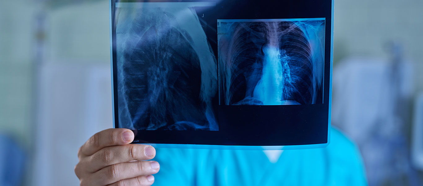 BRCC-Cancer-Sub-Banner-Mesothelioma-01