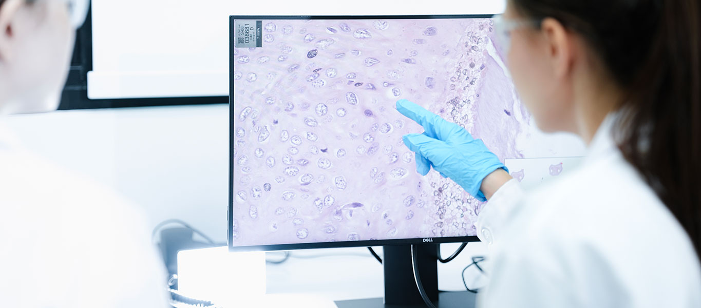 BRCC-Cancer-Sub-Banner-Multiple-Myeloma-01