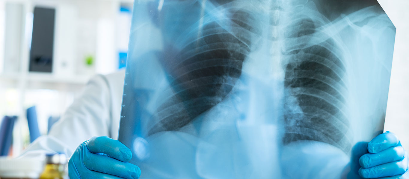 BRCC-Cancer-Sub-Banner-Non-Small-Cell-Lung-01