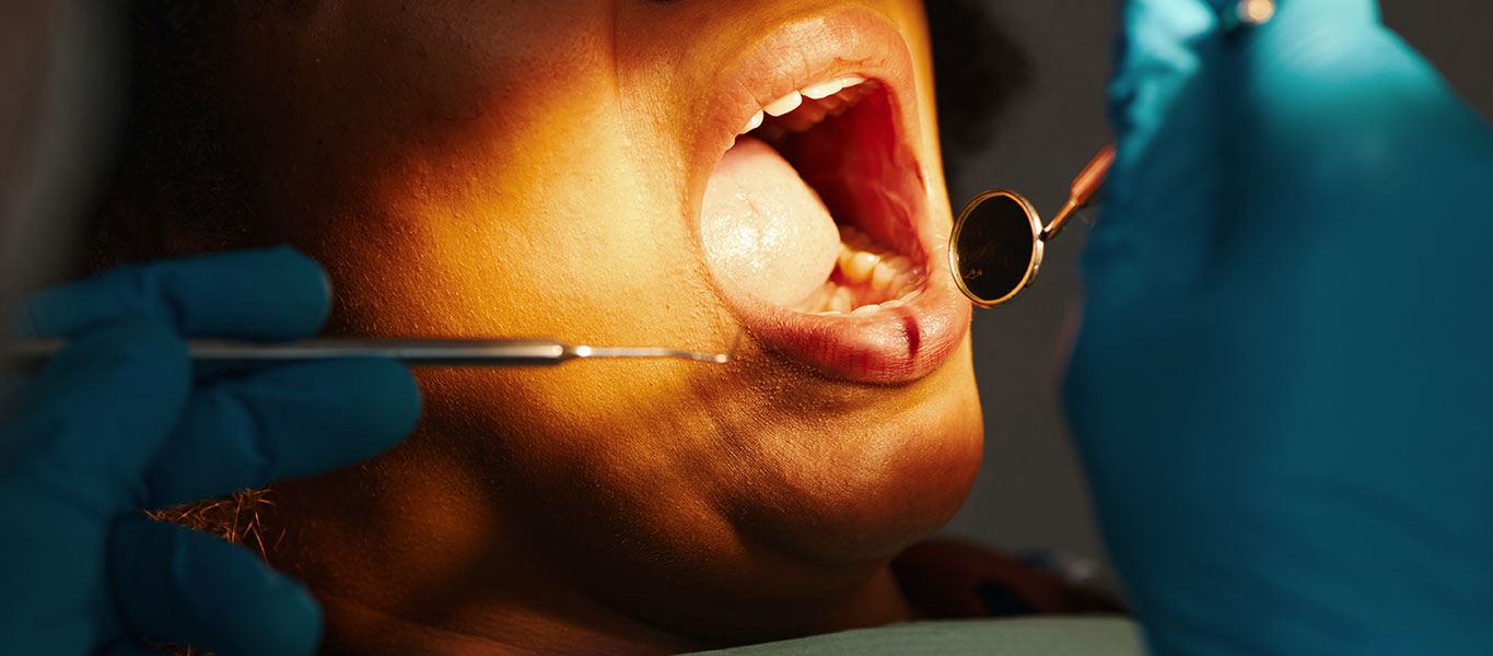 BRCC-Cancer-Sub-Banner-Oral-01