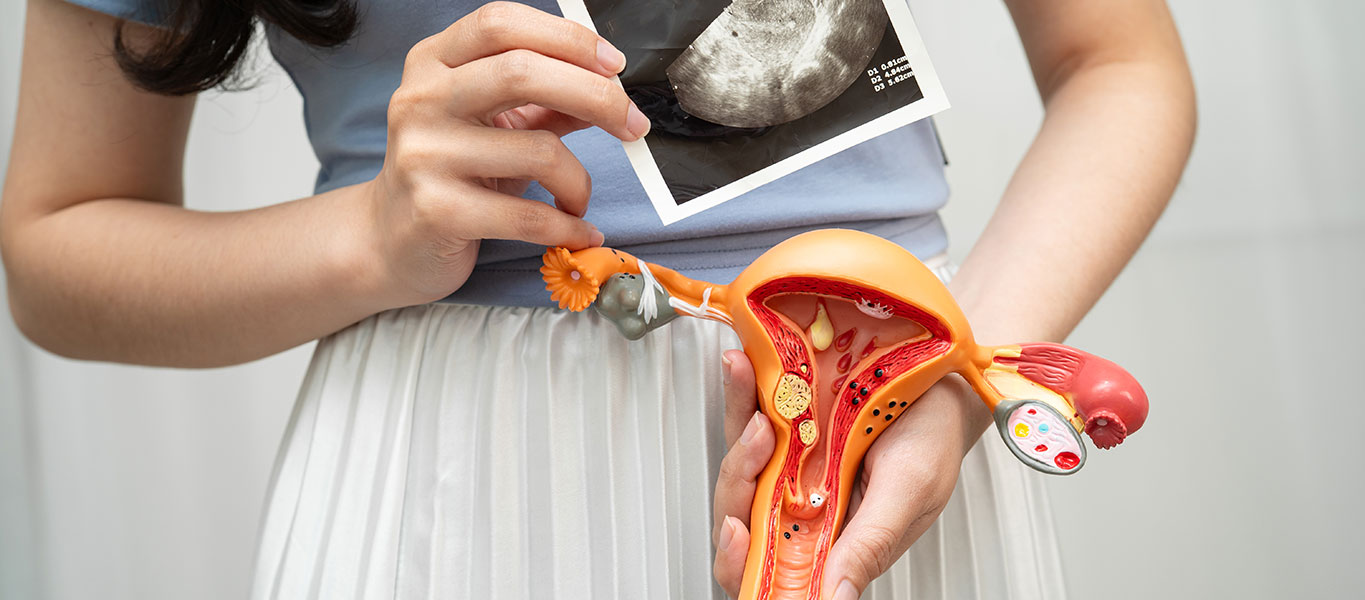BRCC-Cancer-Sub-Banner-Ovarian-01